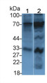 2',5'-Oligoadenylate Synthetase 2 (OAS2) Monoclonal Antibody, CAU30534