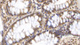 DAB staining on IHC-P; Samples: Human Colon Tissue; Primary Ab: 40µg/ml Mouse Anti-Human OAS2 Antibody Second Ab: 2µg/mL HRP-Linked Caprine Anti-Mouse IgG Polyclonal Antibody