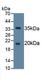 Serine Peptidase Inhibitor Kazal Type 5 (SPINK5) Monoclonal Antibody, CAU30543