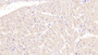 DAB staining on IHC-P; Samples: Human Cardiac Muscle Tissue;  Primary Ab: 10µg/ml Mouse Anti-Human TNNT2 Antibody Second Ab: 2µg/mL HRP-Linked Caprine Anti-Mouse IgG Polyclonal Antibody 