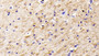 DAB staining on IHC-P; Samples: Human Cerebrum Tissue;  Primary Ab: 40µg/ml Mouse Anti-Human NGF Antibody Second Ab: 2µg/mL HRP-Linked Caprine Anti-Mouse IgG Polyclonal Antibody 