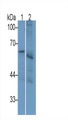 Interleukin 2 Receptor Beta (IL2Rb) Monoclonal Antibody, CAU30612