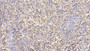 DAB staining on IHC-P; Samples: Human Spleen Tissue;  Primary Ab: 30µg/ml Mouse Anti-Human IL2Rb Antibody Second Ab: 2µg/mL HRP-Linked Caprine Anti-Mouse IgG Polyclonal Antibody 