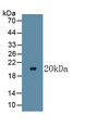 Lymphotoxin Beta Receptor (LTbR) Monoclonal Antibody, CAU30634