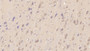 DAB staining on IHC-P; Samples: Human Cerebrum Tissue;  Primary Ab: 30µg/ml Mouse Anti-Human NT-ProBNP Antibody Second Ab: 2µg/mL HRP-Linked Caprine Anti-Mouse IgG Polyclonal Antibody 