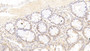 DAB staining on IHC-P; Samples: Human Colon Tissue; Primary Ab: 20μg/ml Mouse Anti-Human PCNA Antibody Second Ab: 2µg/mL HRP-Linked Caprine Anti-Mouse IgG Polyclonal Antibody