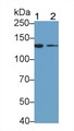 Insulin Receptor (INSR) Monoclonal Antibody, CAU30691