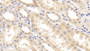 DAB staining on IHC-P; Samples: Human Kidney Tissue; Primary Ab: 30µg/ml Mouse Anti-Human RBP4 Antibody Second Ab: 2µg/mL HRP-Linked Caprine Anti-Mouse IgG Polyclonal Antibody