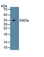 Beta Catenin (β-catenin) Monoclonal Antibody, CAU30700