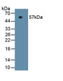 Integrin Beta 1 (ITGb1) Monoclonal Antibody, CAU30701