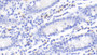 DAB staining on IHC-P; Samples: Human Small intestine Tissue; Primary Ab: 20μg/ml Mouse Anti-Human CTLA4 Antibody Second Ab: 2µg/mL HRP-Linked Caprine Anti-Mouse IgG Polyclonal Antibody