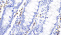 DAB staining on IHC-P; Samples: Human Colon Tissue;  Primary Ab: 20μg/ml Mouse Anti-Human CTLA4 Antibody Second Ab: 2µg/mL HRP-Linked Caprine Anti-Mouse IgG Polyclonal Antibody 