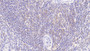 DAB staining on IHC-P; Samples: Human Spleen Tissue;  Primary Ab: 20µg/ml Mouse Anti-Human PRF1 Antibody Second Ab: 2µg/mL HRP-Linked Caprine Anti-Mouse IgG Polyclonal Antibody 