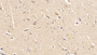 DAB staining on IHC-P; Samples: Human Cerebrum Tissue;  Primary Ab: 30µg/ml Mouse Anti-Human DMD Antibody Second Ab: 2µg/mL HRP-Linked Caprine Anti-Mouse IgG Polyclonal Antibody 