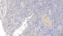 DAB staining on IHC-P; Samples: Human Kidney Tissue;  Primary Ab: 10µg/ml Mouse Anti-Human SDC1 Antibody Second Ab: 2µg/mL HRP-Linked Caprine Anti-Mouse IgG Polyclonal Antibody 