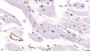 DAB staining on IHC-P; Samples: Human Cardiac Muscle Tissue;  Primary Ab: 40µg/ml Mouse Anti-Human MHCC Antibody Second Ab: 2µg/mL HRP-Linked Caprine Anti-Mouse IgG Polyclonal Antibody 
