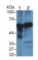 Phenylalanine Hydroxylase (PAH) Monoclonal Antibody, CAU30789