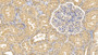 DAB staining on IHC-P; Samples: Human Kidney Tissue; Primary Ab: 20µg/ml Mouse Anti-Human RNLS Antibody Second Ab: 2µg/mL HRP-Linked Caprine Anti-Mouse IgG Polyclonal Antibody