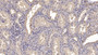 DAB staining on IHC-P; Samples: Human Kidney Tissue; Primary Ab: 10µg/ml Mouse Anti-Human ANXA3 Antibody Second Ab: 2µg/mL HRP-Linked Caprine Anti-Mouse IgG Polyclonal Antibody