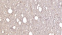 DAB staining on IHC-P; Samples: Human Cerebellum Tissue; Primary Ab: 30µg/ml Mouse Anti-Human GRIA2 Antibody Second Ab: 2µg/mL HRP-Linked Caprine Anti-Mouse IgG Polyclonal Antibody