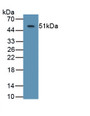 Aspartate Beta Hydroxylase (ASPH) Monoclonal Antibody, CAU30828