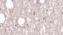 DAB staining on IHC-P; Samples: Human Cerebellum Tissue; Primary Ab: 40µg/ml Mouse Anti-Human ASPH Antibody Second Ab: 2µg/mL HRP-Linked Caprine Anti-Mouse IgG Polyclonal Antibody