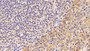 DAB staining on IHC-P; Samples: Human amygdalitis Tissue; Primary Ab: 10μg/ml Mouse Anti-Human ATP1a1 Antibody Second Ab: 2µg/mL HRP-Linked Caprine Anti-Mouse IgG Polyclonal Antibody