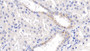 DAB staining on IHC-P; Samples: Human Kidney Tissue;  Primary Ab: 10µg/ml Mouse Anti-Human PARK7 Antibody Second Ab: 2µg/mL HRP-Linked Caprine Anti-Mouse IgG Polyclonal Antibody 