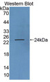 Growth Hormone (GH) Polyclonal Antibody, CAU30876