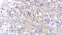 DAB staining on IHC-P; Samples: Porcine Stomach Tissue;  Primary Ab: 20µg/ml Rabbit Anti-Porcine IL13 Antibody Second Ab: 2µg/mL HRP-Linked Caprine Anti-Rabbit IgG Polyclonal Antibody 
