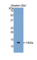 Monocyte Chemotactic Protein 1 (MCP1) Polyclonal Antibody, CAU30927