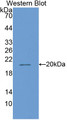 Matrix Metalloproteinase 13 (MMP13) Polyclonal Antibody, CAU30936