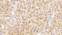 DAB staining on IHC-P; Samples: Rabbit Cardiac Muscle Tissue;  Primary Ab: 30µg/ml  Cavia Anti-Rabbit SOD3 Antibody Second Ab: 2µg/mL HRP-Linked Rabbit Anti-Cavia IgG Polyclonal Antibody 