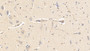 DAB staining on IHC-P; Samples: Bovine Cerebellum Tissue; Primary Ab: 20μg/ml Rabbit Anti-Bovine aHSG Antibody Second Ab: 2µg/mL HRP-Linked Caprine Anti-Rabbit IgG Polyclonal Antibody