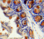 Used in DAB staining on fromalin fixed paraffin-embedded Intestine tissue