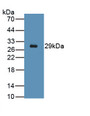 Desmin (Des) Polyclonal Antibody, CAU31042