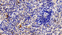 DAB staining on IHC-P; Samples: Rabbit Spleen Tissue; Primary Ab: 10μg/ml Cavia Anti-Rabbit MMP9 Antibody Second Ab: 2µg/mL HRP-Linked Rabbit Anti-Cavia IgG Polyclonal Antibody
