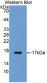 Aquaporin 1 (AQP1) Polyclonal Antibody, CAU31157