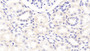 DAB staining on IHC-P; Samples: Bovine Kidney Tissue; Primary Ab: 30µg/ml Rabbit Anti-Bovine APOB100 Antibody Second Ab: 2µg/mL HRP-Linked Caprine Anti-Rabbit IgG Polyclonal Antibody