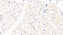 DAB staining on IHC-P; Samples: Bovine Cardiac Muscle Tissue; Primary Ab: 30µg/ml Rabbit Anti-Bovine APOB100 Antibody Second Ab: 2µg/mL HRP-Linked Caprine Anti-Rabbit IgG Polyclonal Antibody