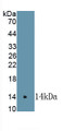Cyclooxygenase-2 (COX 2) Polyclonal Antibody, CAU31194