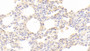 DAB staining on IHC-P; Samples: Human Lung Tissue; Primary Ab: 10μg/ml Rabbit Anti-Human HPA Antibody Second Ab: 2µg/mL HRP-Linked Caprine Anti-Rabbit IgG Polyclonal Antibody