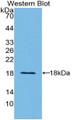 Prealbumin (PALB) Polyclonal Antibody, CAU31199