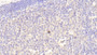 DAB staining on IHC-P; Samples: Human Lymph node Tissue; Primary Ab: 20μg/ml Rabbit Anti-Human TLR4 Antibody Second Ab: 2µg/mL HRP-Linked Caprine Anti-Rabbit IgG Polyclonal Antibody