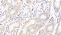 DAB staining on IHC-P; Samples: Human Stomach Tissue; Primary Ab: 20μg/ml Rabbit Anti-Human TLR4 Antibody Second Ab: 2µg/mL HRP-Linked Caprine Anti-Rabbit IgG Polyclonal Antibody