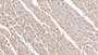 DAB staining on IHC-P; Samples: Human Cardiac Muscle Tissue;  Primary Ab: 10µg/ml Rabbit Anti-Human MYH2 Antibody Second Ab: 2µg/mL HRP-Linked Caprine Anti-Rabbit IgG Polyclonal Antibody 