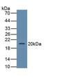 Podocalyxin (PODXL) Polyclonal Antibody, CAU31209