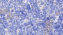 DAB staining on IHC-P; Samples: Mouse Spleen Tissue;  Primary Ab: 20µg/ml Rabbit Anti-Mouse CXCL16 Antibody Second Ab: 2µg/mL HRP-Linked Caprine Anti-Rabbit IgG Polyclonal Antibody 