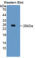 Prolactin (PRL) Polyclonal Antibody, CAU31263