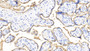 DAB staining on IHC-P; Samples: Human Placenta Tissue;  Primary Ab: 20μg/ml Rabbit Anti-Human ALPI Antibody Second Ab: 2µg/mL HRP-Linked Caprine Anti-Rabbit IgG Polyclonal Antibody 